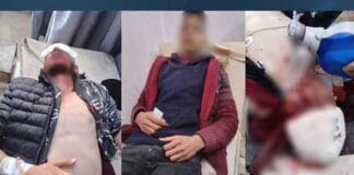 Tirkiyê Şehba topbaran kir